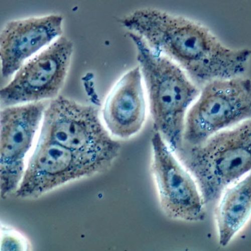 The Immortal Life of Henrietta Lacks – Book Review